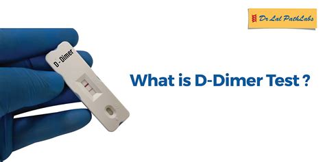 Dimer .